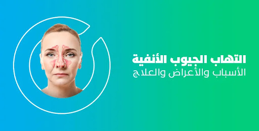 أسباب وأعراض وعلاج التهاب الجيوب الأنفية واحتقان الأنف - منصة بوابة الشام