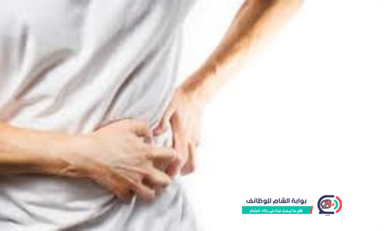| كل ما تود معرفته عن أسباب تراكم الأملاح في الكلى وطرق علاجها بوابة الشام | تراكم الأملاح في الكلى: من البلورات الصغيرة إلى الحصوات.. كيف تقي نفسك؟