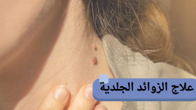 علاج الزوائد الجلدية: أفضل الطرق الطبية والطبيعية للتخلص منها بأمان