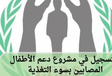 التسجيل في مشروع دعم الأطفال المصابين بسوء التغذية بمستشفى أصدقاء المريض