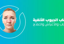 أسباب وأعراض وعلاج التهاب الجيوب الأنفية واحتقان الأنف - منصة بوابة الشام